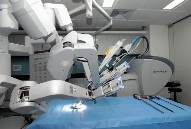 Роботизированный хирургический комплекс «да Винчи»